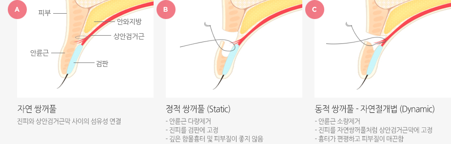 ‘Dynamic method’란 일러스트 이미지