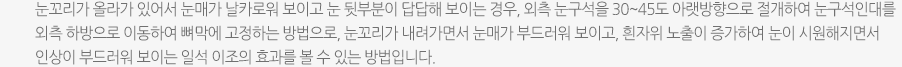 눈꼬리가 올라가 있어서 눈매가 날카로워 보이고 눈 뒷부분이 답답해 보이는 경우, 외측 눈구석을 30~45도 아랫방향으로 절개하여 눈구석인대를 외측 하방으로 이동하여 뼈막에 고정하는 방법으로, 눈꼬리가 내려가면서 눈매가 부드러워 보이고, 흰자위 노출이 증가하여 눈이 시원해지면서 인상이 부드러워 보이는 일석 이조의 효과를 볼 수 있는 방법입니다.