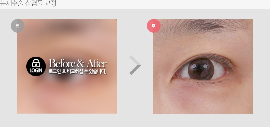Before & After