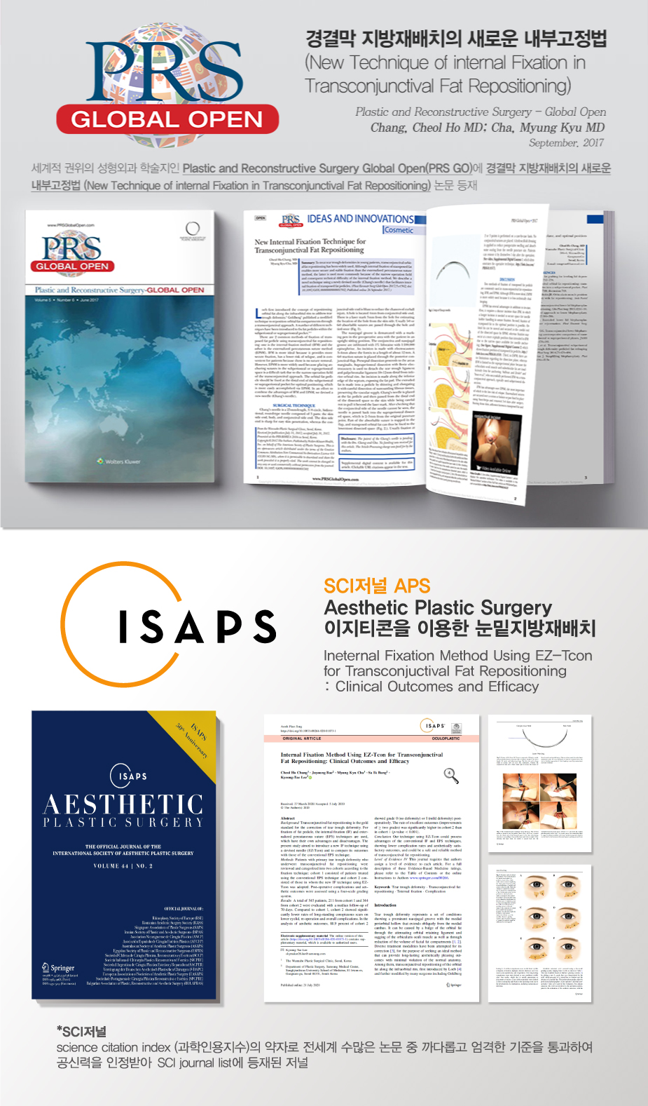 ISAPS SCI저널 논문