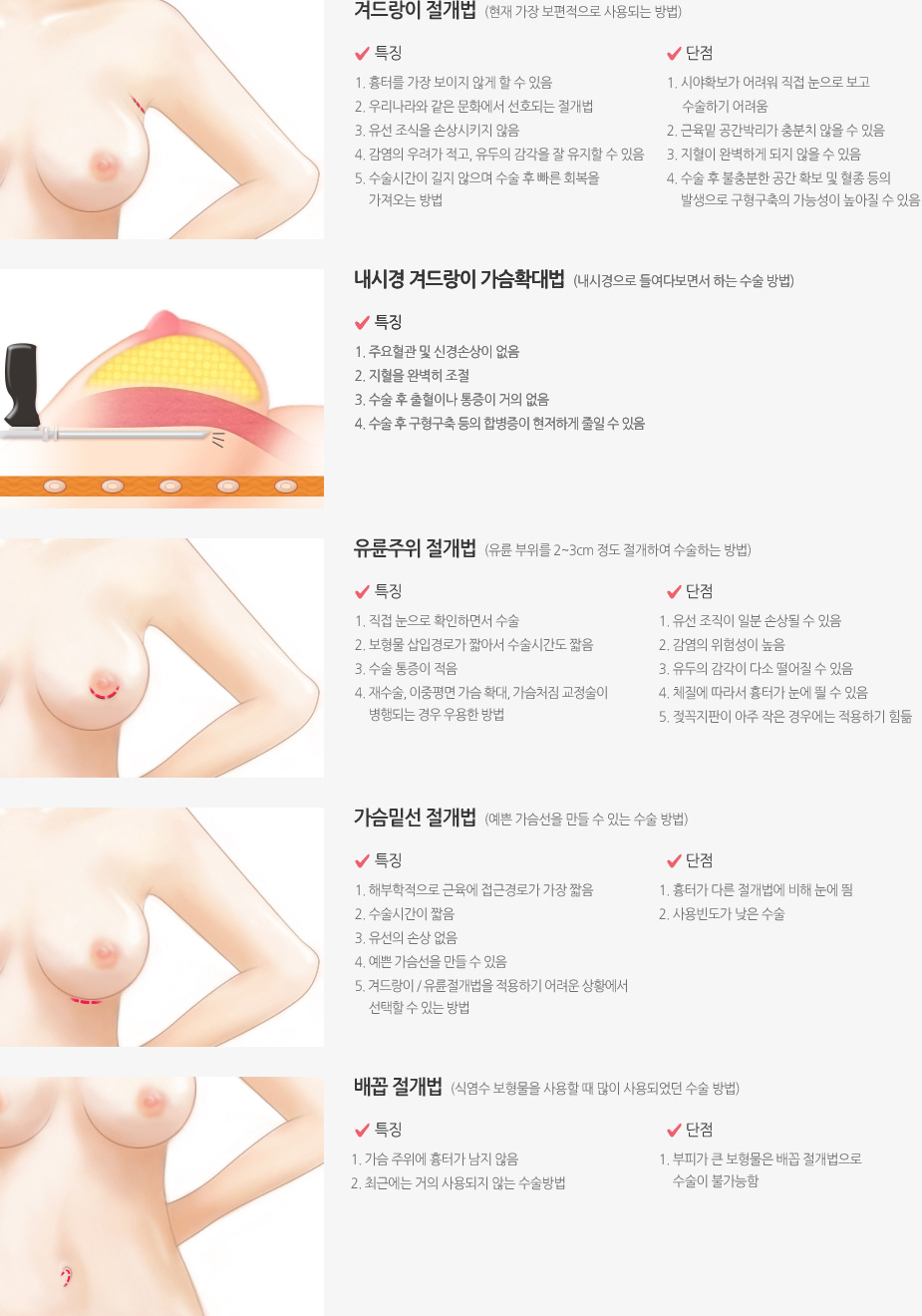 절개법 소개